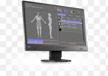 acquisition and diagnostic software for x-ray images - computer monitor