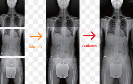 adding annotation text, graphics and electronic markers - x ray stitching