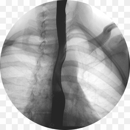 fluoroscopy x ray
