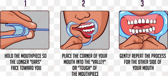 how to clean your mouth pieces - watch your mouth instructions