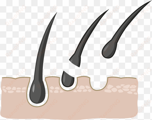 regrow restablece y restaura los folículos capilares - raiz de cabello png