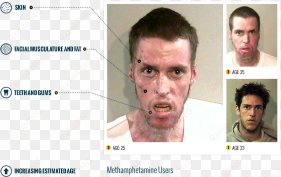 the affects of meth - meth addict