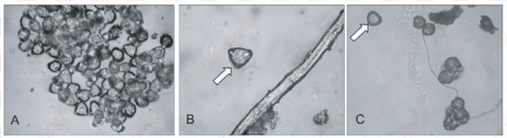 wind-transported apple pollen grains observed on pollen - visual arts
